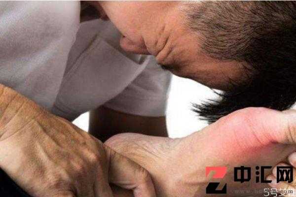 痛风造成的原因有什么 痛风应该怎么治疗